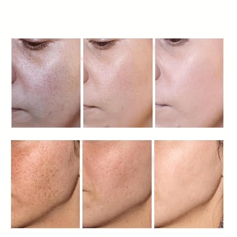 Dark Spot Fade Cream for Face Body Sensitive Areas