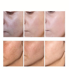 Dark Spot Fade Cream for Face Body Sensitive Areas