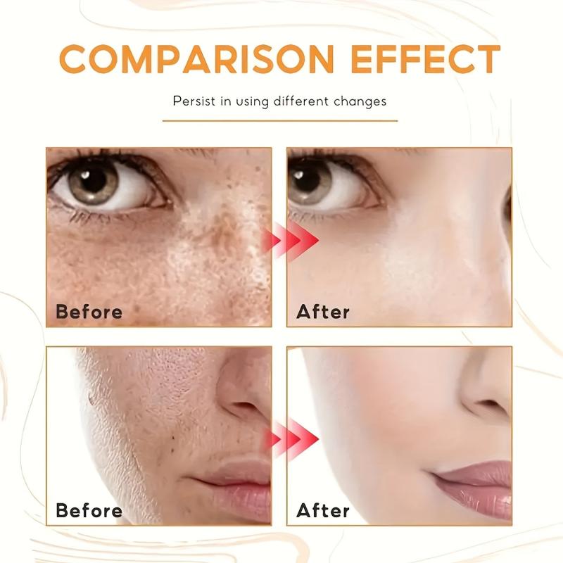 Dark Spot Fade Cream for Face Body Sensitive Areas