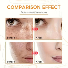 Dark Spot Fade Cream for Face Body Sensitive Areas