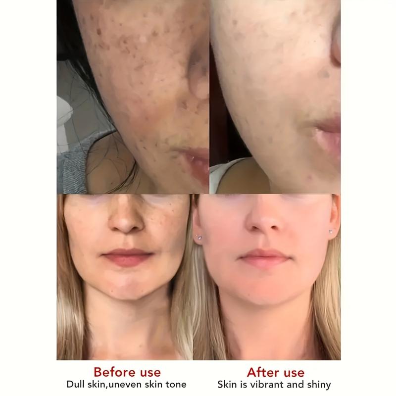 Dark Spot Remover for Face and Body - Repair and Smooth Skin