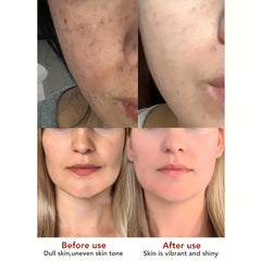 Dark Spot Remover for Face and Body - Repair and Smooth Skin