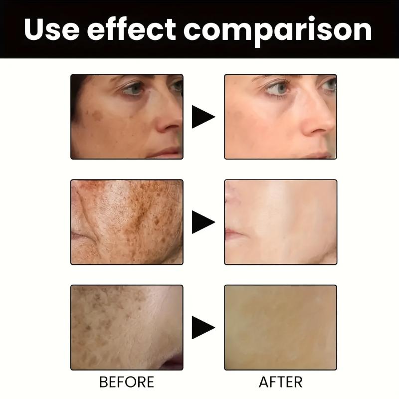 Dark Spot Remover for Face and Body - Repair and Smooth Skin