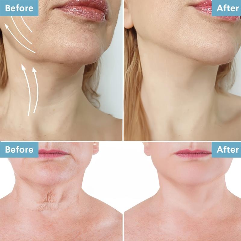 Neck Renewal Cream Reduce Fine Lines Moisturizing Firming Beauty Neck Cream