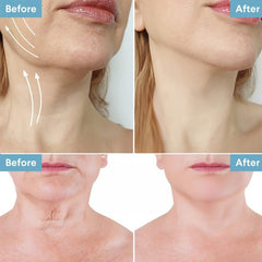 Neck Renewal Cream Reduce Fine Lines Moisturizing Firming Beauty Neck Cream