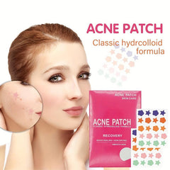 Star & Flower Acne Patches for Face Non Irritating Acne Removing