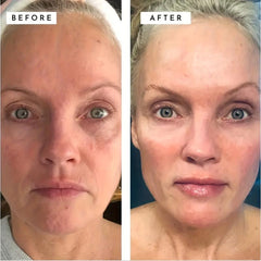 Anti Aging Retinol Cream with Collagen Hyaluronic Acid Vitamin C E