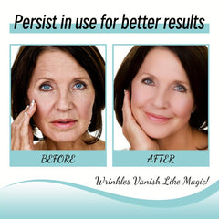 Wrinkles Stick for Smooth Forehead - Fade Facial Wrinkles