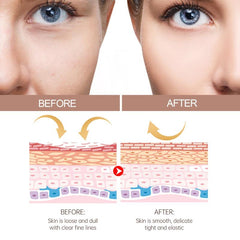 Moisturizing Cream Hydrating Face Lotion Soothes Dry Skin Improves Elasticity
