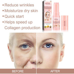 Moisturizing Cream Hydrating Face Lotion Soothes Dry Skin Improves Elasticity