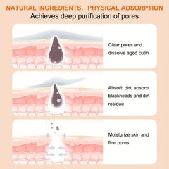 Hydrocolloid Acne Patches For Pimple Zit Patch