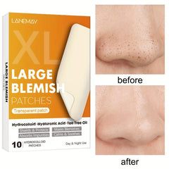 Hydrocolloid Acne Patches For Pimple Zit Patch