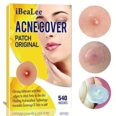 Acne Pimple Patches, Deep Cleansing Pore Stickers, Cover Zits & Blemishes