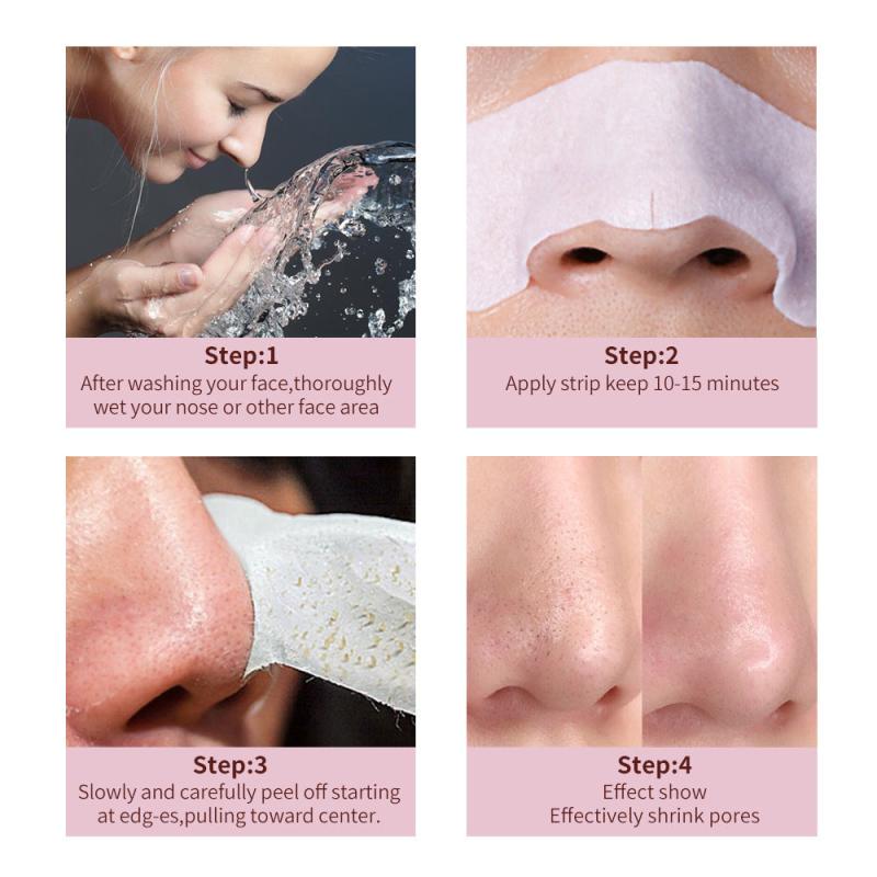 10pcs Blackhead Nose Strips with Calendula - Pore Refining Skin Care