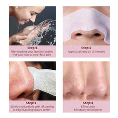 10pcs Blackhead Nose Strips with Calendula - Pore Refining Skin Care
