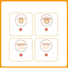 5 Pack Invisible Waterproof Acne Patch Hydrocolloid Concealer