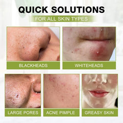 Dead Sea Mud Tear Off Mask Blackhead Remover Cream