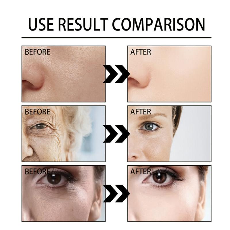Active Retinol Face Cream for Revitalized Skin Hyaluronic Acid & Collagen