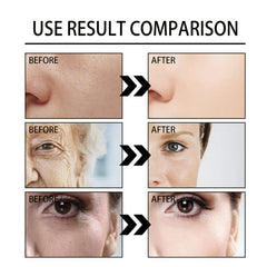 Active Retinol Face Cream for Revitalized Skin Hyaluronic Acid & Collagen