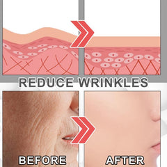 Anti-Aging Retinol Cream with Hyaluronic Acid & Collagen