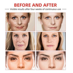 Anti-Aging Retinol Cream with Hyaluronic Acid & Collagen