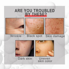 Anti-Aging Retinol Cream with Hyaluronic Acid & Collagen