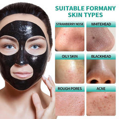 Bamboo Charcoal Blackhead Care Mask Absorbs Blackheads Acne Horniness