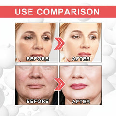 Retinol Face Cream Moisturize for Elastic Skin