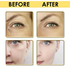Retinol Cream & Hyaluronic Acid Advanced Formula