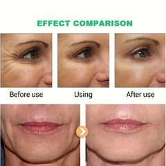 Retinol Cream & Hyaluronic Acid Advanced Formula