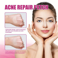 Invisible Acne Patch Breathable Concealer Clean Repair Acne Patch