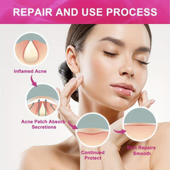 Invisible Acne Patch Breathable Concealer Clean Repair Acne Patch
