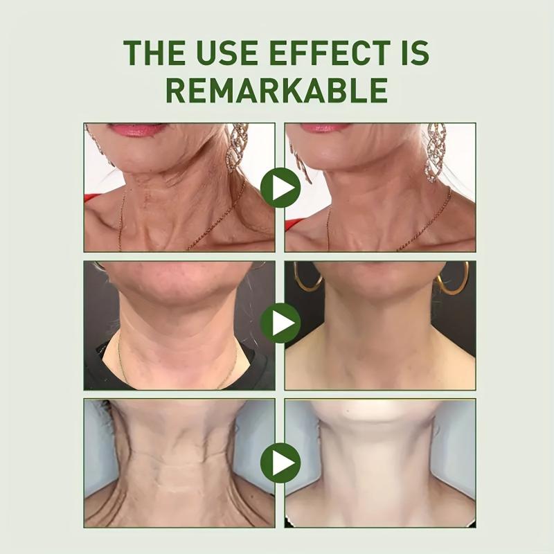 Neck Renewal Cream Retinol Collagen Hyaluronic Acid Smoothing Wrinkles
