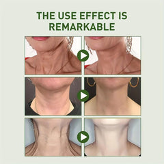 Neck Renewal Cream Retinol Collagen Hyaluronic Acid Smoothing Wrinkles