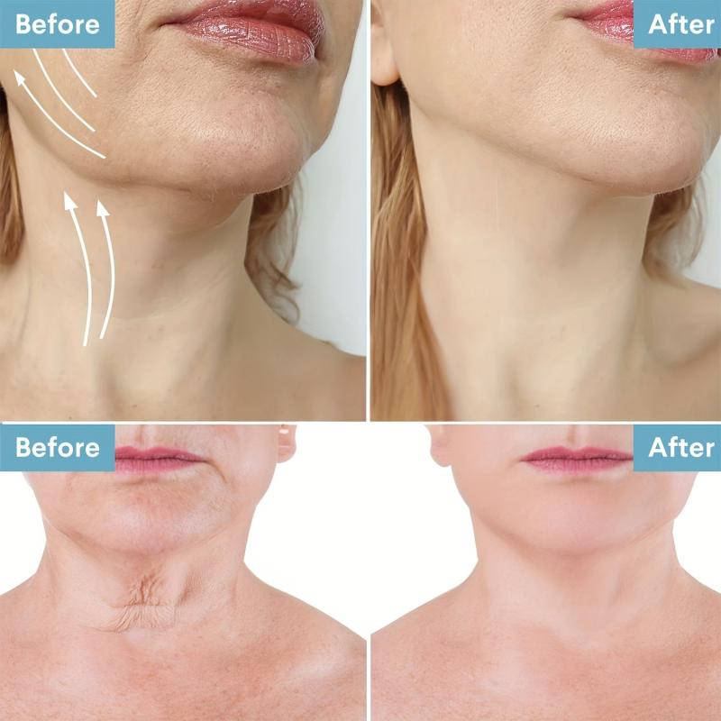 Neck Renewal Cream Retinol Collagen Hyaluronic Acid Smoothing Wrinkles