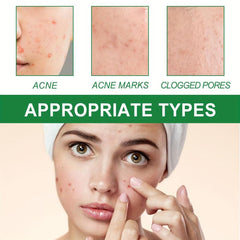 Deep Cleansing Facial Skin Repairing Mask