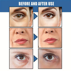 Retinol Face Cream Anti-Wrinkle Moisturizer