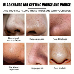 Blackhead Stickers Deep Cleansing Nose Blackhead Acne Tight And Delicate Pores
