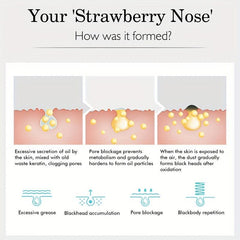 Nose Patches 10pcs Blackheads Removal Dead Skin Smoothing Revitalizing Skin