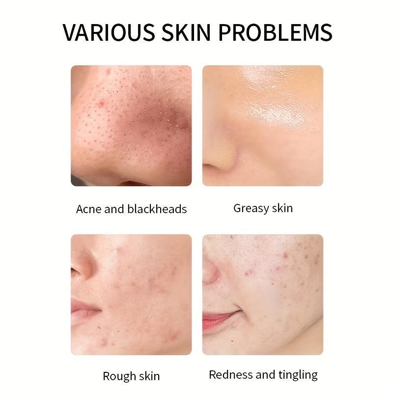 Deep Pore Cleansing Mud Mask