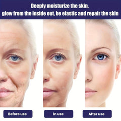 Anti Wrinkle Cream Diminishes Spots And Fine Lines