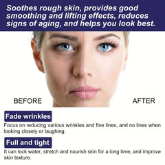 Anti Wrinkle Cream Diminishes Spots And Fine Lines