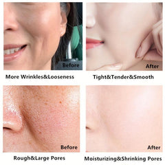 Face Cream Moisturizing Skin Non-Irritating Improves Dry Skin