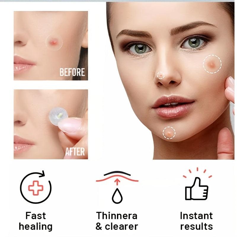 Acne Pimple Patches Transparent Hydrocolloid Skin Care Facial Acne Patches 36pcs