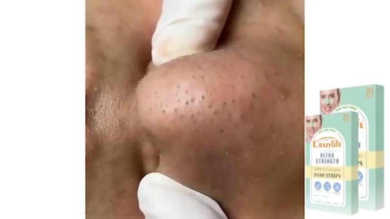 20pcs Nose Mask for Men and Women Deep Cleans and Exfoliates Skin