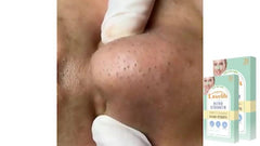 20pcs Nose Mask for Men and Women Deep Cleans and Exfoliates Skin
