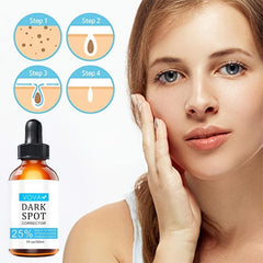 Dark Spot Fade Serum for Hyperpigmentation Care - 1 Fl Oz