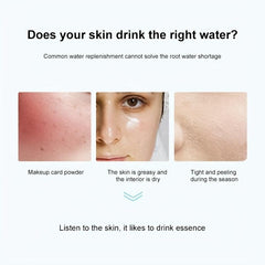 Hyaluronic Acid Moisturizing Spray for Face and Body