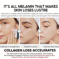 Whitening Freckle Spot Set for Middle-aged Spots