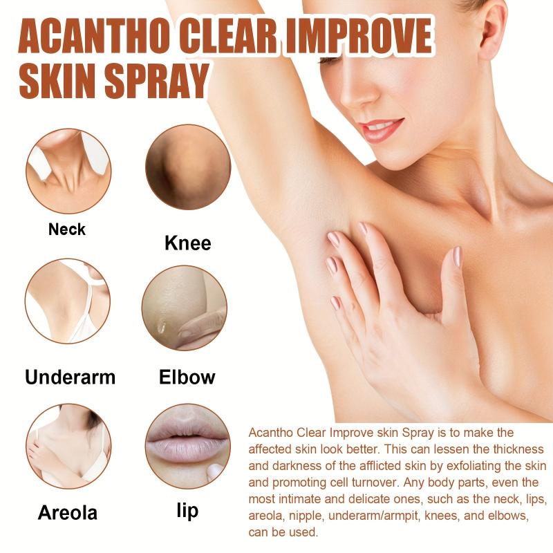 30ml Acantho Clear Spray Dark Spot Correction Improve Skin Texture